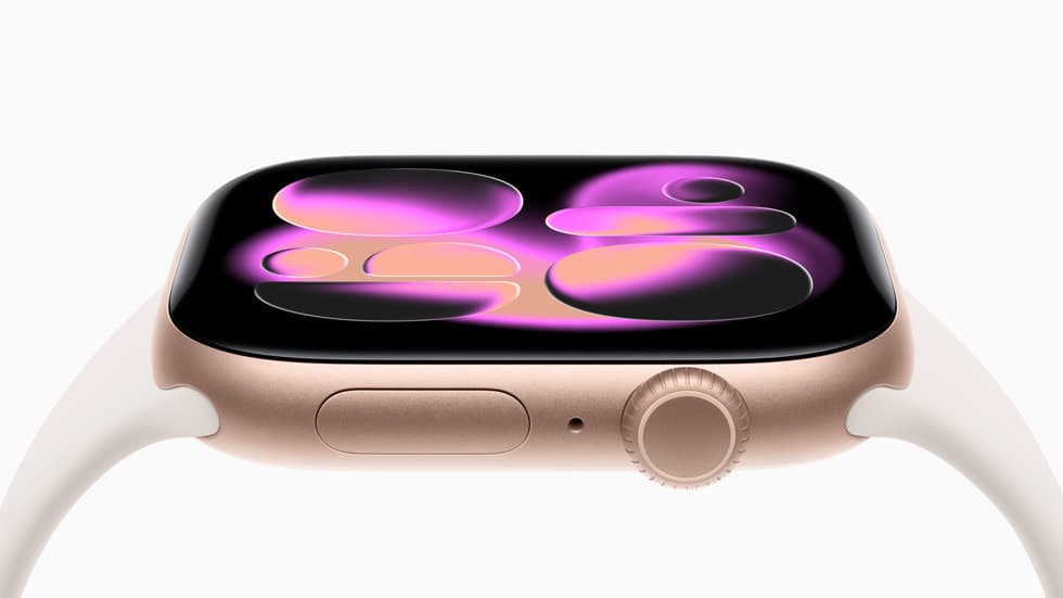 Apple Watch Series 11 - Used — view 2